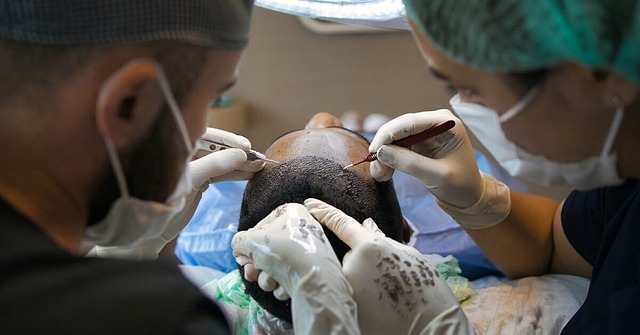 Den ultimative guide til hårtransplantation: Hvordan det fungerer og hvad du kan forvente